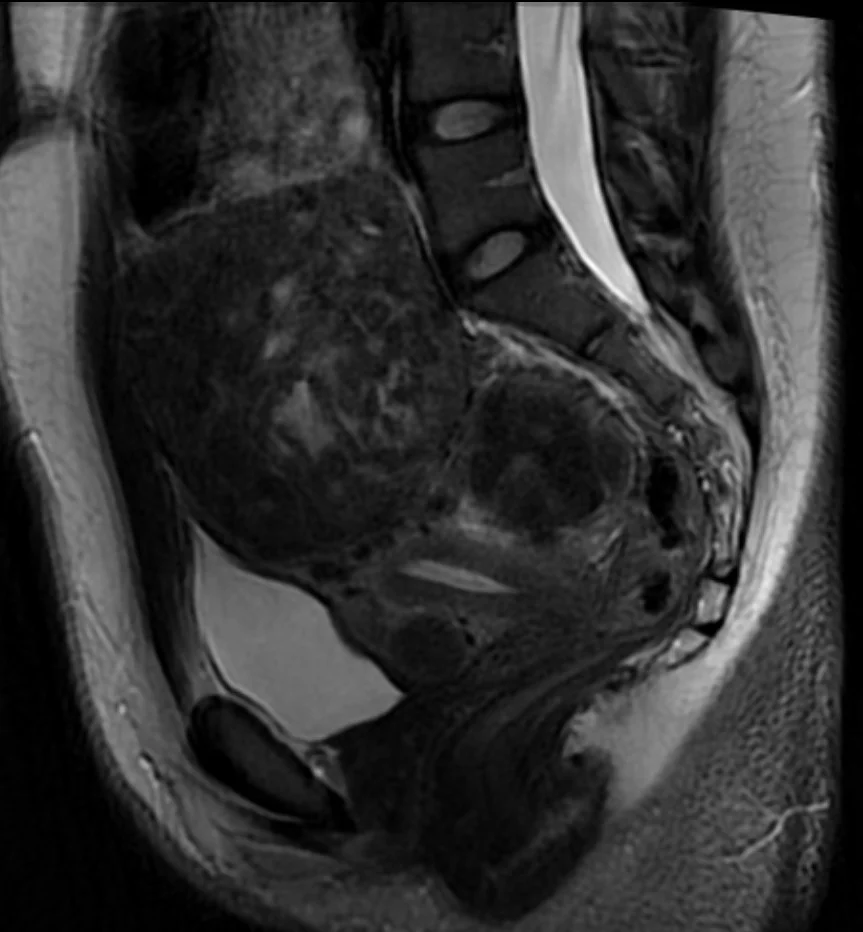 FRCR 2B long case - Diagnostic quality CT scan for radiology training