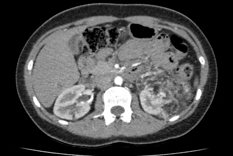 FRCR 2B rapid reporting - Authentic radiograph with expert annotations