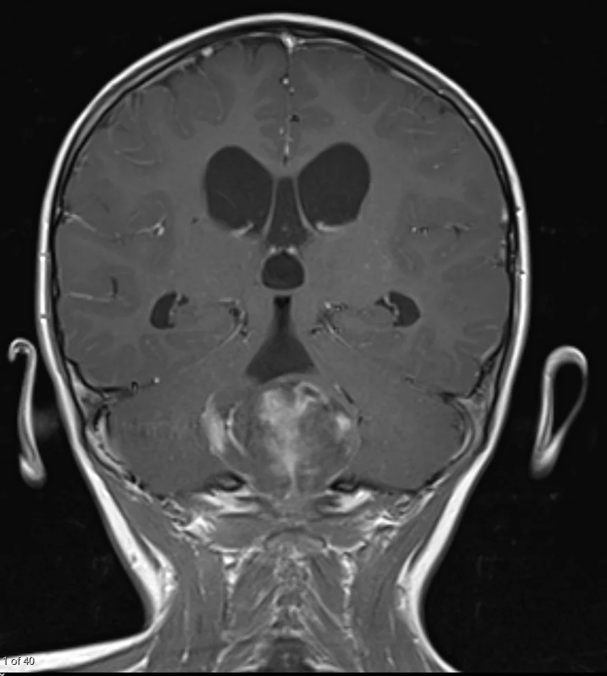 FRCR 2B practice - Cross-sectional imaging at workstation quality