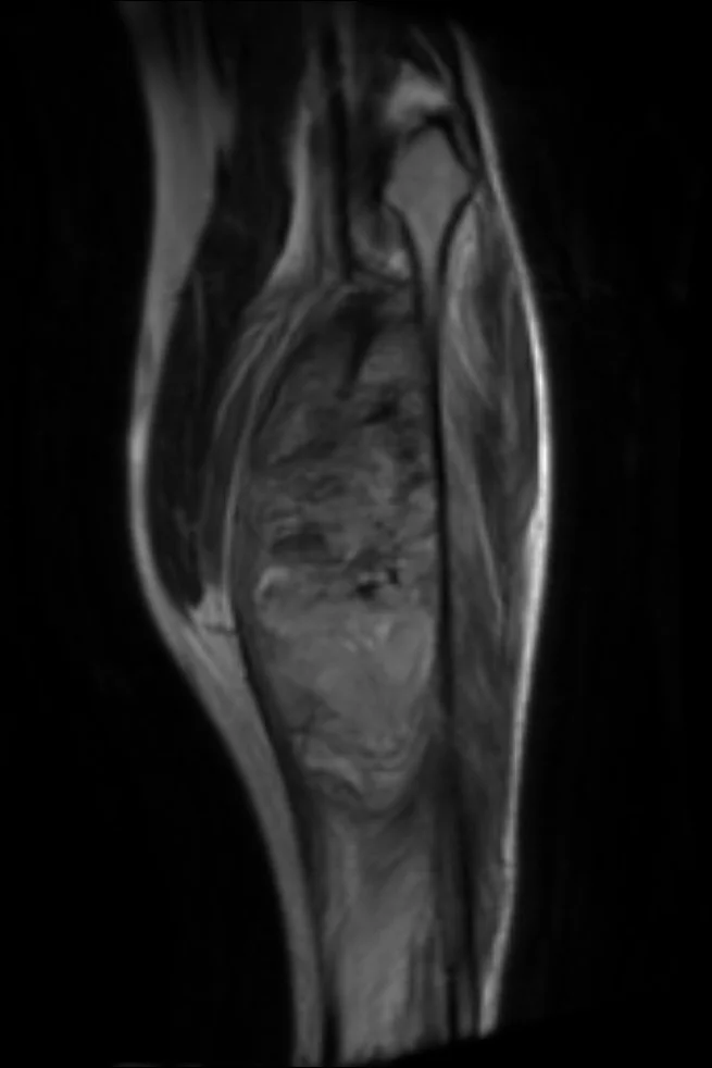 FRCR 2B MRI case - Full lossless DICOM following RCR guidelines