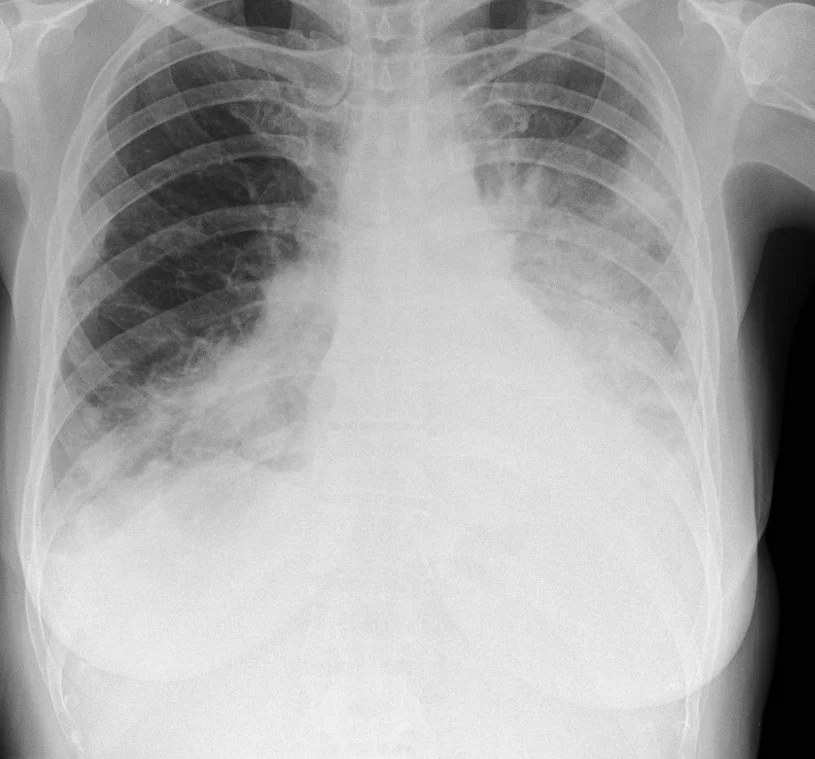 FRCR 2B exam preparation - Human-created radiology content