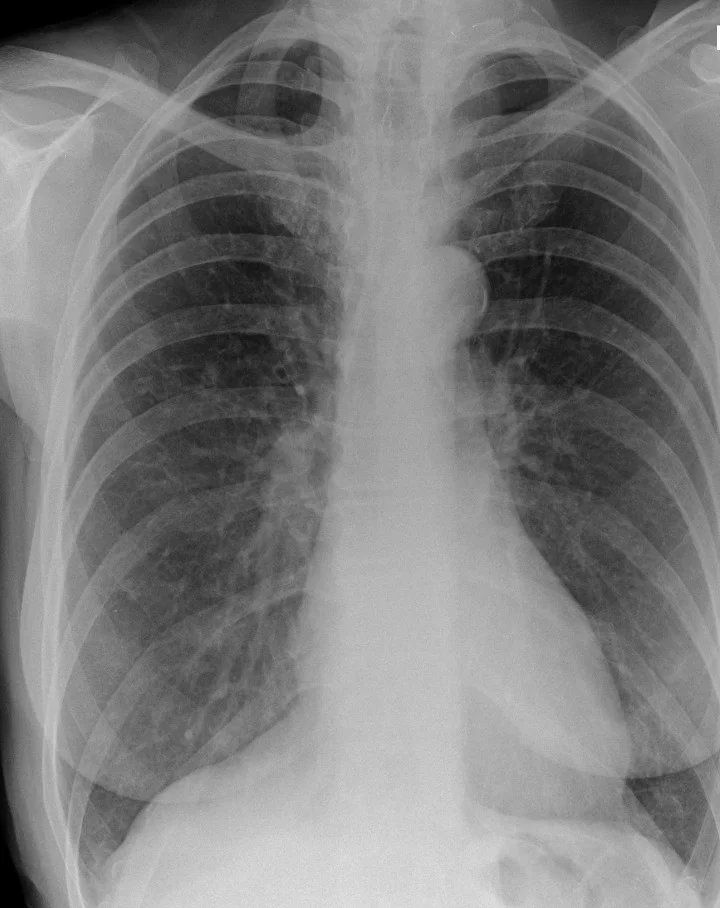 FRCR 2B long case packet - Diagnostic workstation quality image