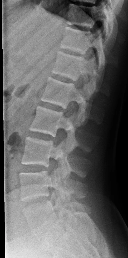 FRCR 2B rapid reporting MRI - Full lossless DICOM format