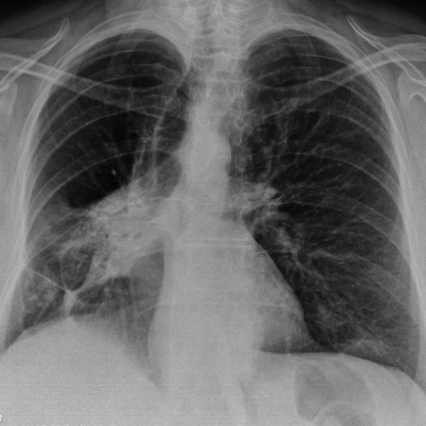 FRCR 2B reporting X-ray - Expert radiologist created content