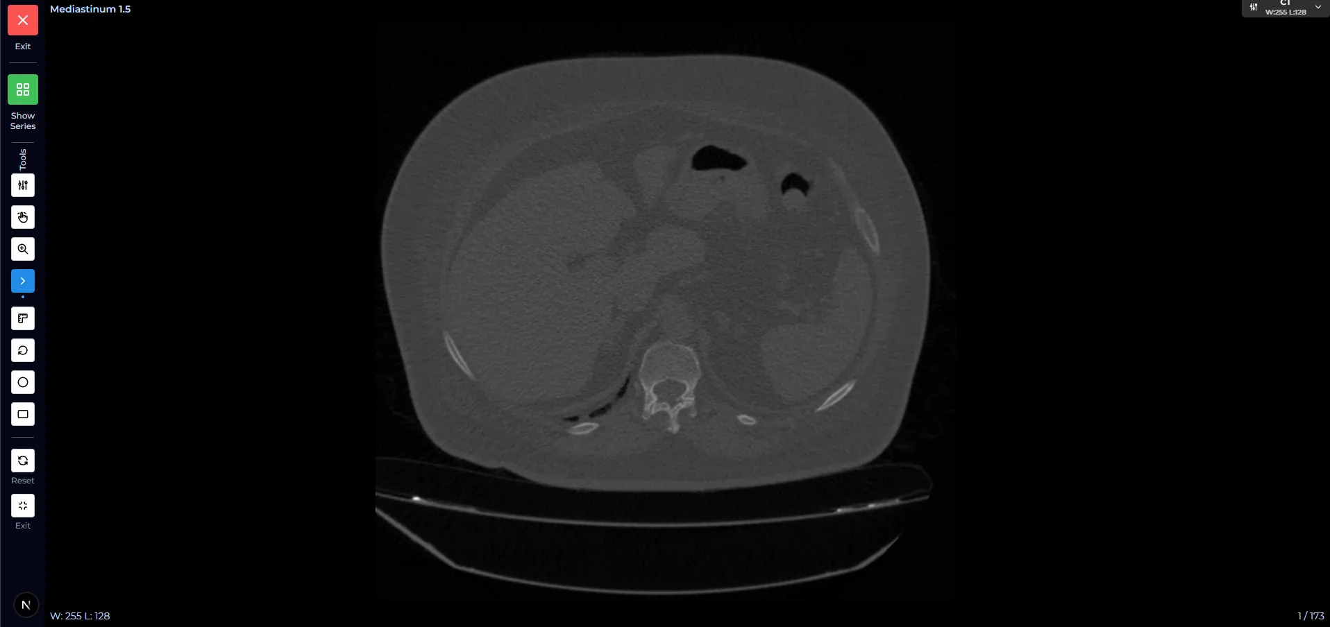 MyFRCR DICOM viewer displaying full lossless medical images at diagnostic workstation quality